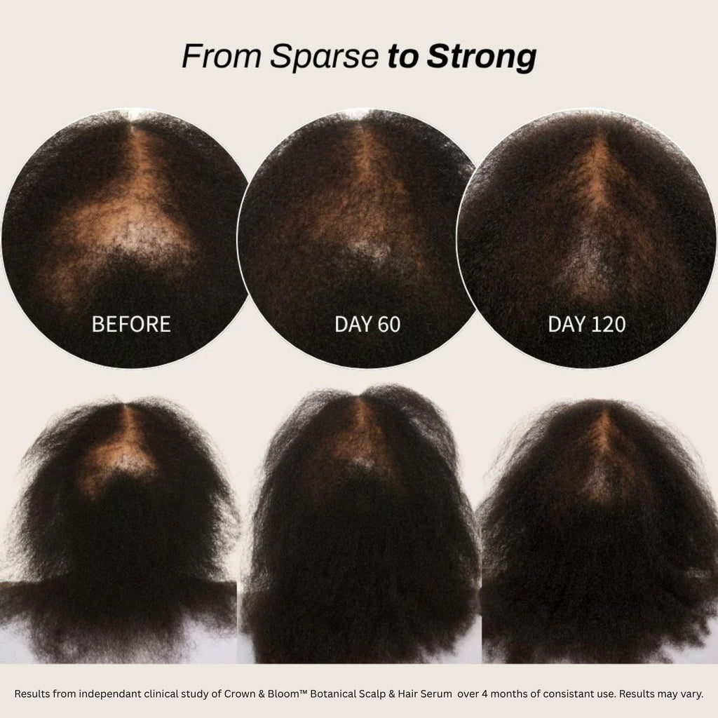 Crown & Bloom™ Botanical Scalp & Hair Serum